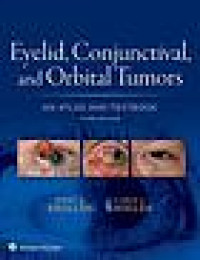Eyelid, conjunctival, and orbital tumors : atlas and textbook