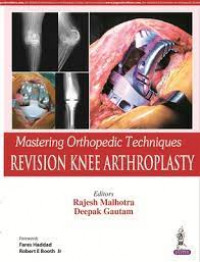 Mastering orthopedic techniques: revision knee arthroplasty