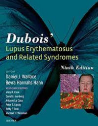 Dubois' lupus erythematosus and related syndromes