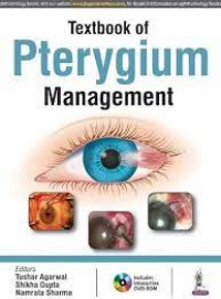Textbook pterygium management