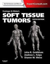 Enzinger and Weiss's soft tissue tumors